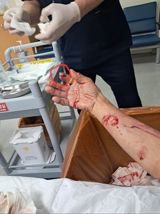 thumbimg